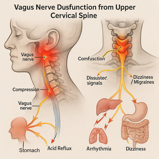 Reasons Your Vagus Nerve Dysfunction