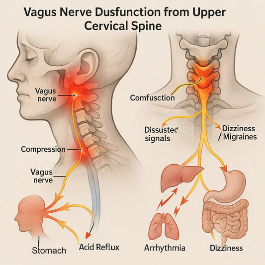 Why Thousands With Neck Pain, Dizziness & Reflux Are Actually Dealing With a Vagus Nerve Problem